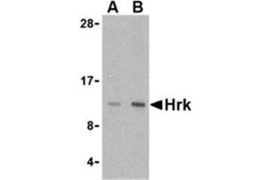 Image no. 1 for anti-Harakiri, BCL2 Interacting Protein (Contains Only BH3 Domain) (HRK) (Middle Region) antibody (ABIN318750) (HRK 抗体  (Middle Region))