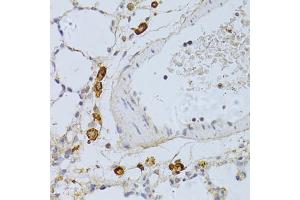 Immunohistochemistry of paraffin-embedded rat lung using PHGDH antibody (ABIN4904748) at dilution of 1:100 (40x lens). (PHGDH 抗体)
