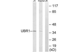 Western blot analysis of extracts from Jurkat cells and HepG2 cells, using UBR1 antibody. (UBR1 抗体  (Internal Region))