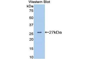 Western Blotting (WB) image for anti-Clusterin (CLU) (AA 227-448) antibody (ABIN1077938) (Clusterin 抗体  (AA 227-448))