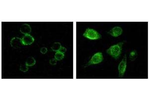 Immunofluorescence staining of methanol-fixed MCF-7 and HepG2 cells showing membrane and cytoplasmic localization.