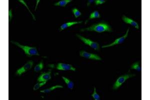 Immunofluorescence staining of Hela cells with ABIN7169960 at 1:100, counter-stained with DAPI. (SLC5A8 抗体  (AA 540-610))