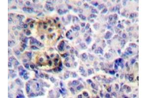 Immunohistochemistry analyzes of Moesin antibody in paraffin-embedded human pancreas tissue. (Moesin 抗体)