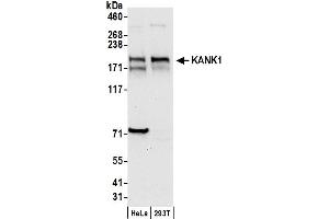 Western Blotting (WB) image for anti-Ankyrin Repeat Domain 15 (ANKRD15) (AA 1302-1352) antibody (ABIN7450385)