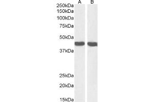 Western Blotting (WB) image for anti-Actin, alpha 2, Smooth Muscle, Aorta (ACTA2) (N-Term) antibody (ABIN185271)