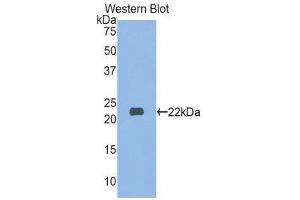Western Blotting (WB) image for anti-Myosin, Light Chain 3 (MYL3) (AA 5-181) antibody (ABIN1859940) (MYL3/CMLC1 抗体  (AA 5-181))