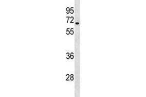 HAS3 antibody western blot analysis in A549 lysate. (HAS3 抗体  (AA 137-164))