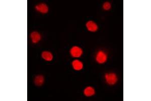Immunofluorescent analysis of DBF4 staining in HepG2 cells. (DBF4 抗体  (N-Term))