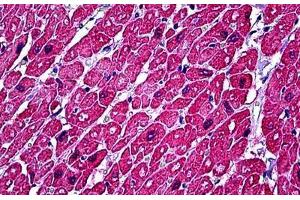 Human Heart: Formalin-Fixed, Paraffin-Embedded (FFPE) (TNNC1 抗体)