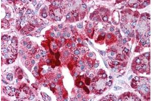 Immunohistochemistry (Formalin-fixed Paraffin-embedded Sections) (IHC (fp)) image for anti-Hydroxyacyl-CoA Dehydrogenase/3-Ketoacyl-CoA Thiolase/enoyl-CoA Hydratase (Trifunctional Protein), beta Subunit (HADHB) (AA 351-400) antibody (ABIN604755)