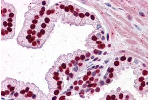 Human Prostate: Formalin-Fixed, Paraffin-Embedded (FFPE) (SMAD6 抗体  (AA 285-385))