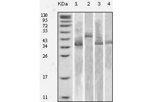Western blot analysis using Trx mouse mAb against various fusion protein with Trx tag. (TXN 抗体)