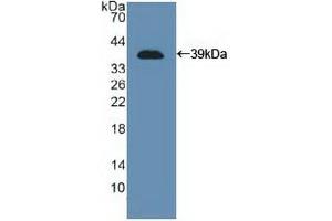 Detection of Recombinant NCAM, Human using Polyclonal Antibody to Cluster Of Differentiation 56 (CD56) (CD56 抗体  (AA 340-608))