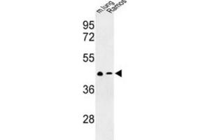 Western Blotting (WB) image for anti-Chemokine (C-X-C Motif) Receptor 7 (CXCR7) antibody (ABIN3003904) (CXCR7 抗体)