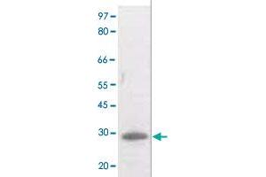 The whole cell lysate derived from UV treated Raji cell was separated in 10% SDS-PAGE, transferred onto NC membrane, and immunoblotted by BCL2 (phospho T129) polyclonal antibody  at 1 : 500. (Bcl-2 抗体  (pThr129))