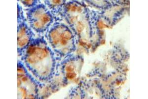 Used in DAB staining on fromalin fixed paraffin-embedded Intestine tissue (RETNLB 抗体  (AA 24-105))