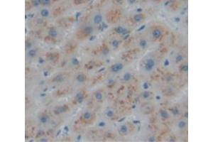 IHC-P analysis of Human Tissue, with DAB staining. (LACTB 抗体  (AA 313-547))