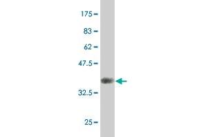 Western Blot detection against Immunogen (35. (AKT2 抗体  (AA 100-189))