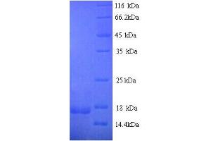SDS-PAGE (SDS) image for Luteinizing Hormone beta Polypeptide (LHB) (AA 21-141) protein (His tag) (ABIN7691115)