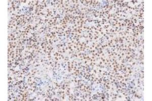 Immunohistochemistry (IHC) image for anti-TAR DNA Binding Protein (TARDBP) (AA 1-260), (N-Term) antibody (ABIN317572) (TARDBP 抗体  (N-Term))