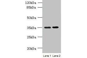 Western blot All lanes: CFAP65 antibody at 8 μg/mL Lane 1: U251 whole cell lysate Lane 2: U87 whole cell lysate Secondary Goat polyclonal to rabbit IgG at 1/10000 dilution Predicted band size: 218, 19, 82, 88 kDa Observed band size: 35 kDa (CCDC108 抗体  (AA 2-164))