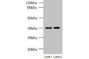 Western blot All lanes: CFAP65 antibody at 8 μg/mL Lane 1: U251 whole cell lysate Lane 2: U87 whole cell lysate Secondary Goat polyclonal to rabbit IgG at 1/10000 dilution Predicted band size: 218, 19, 82, 88 kDa Observed band size: 35 kDa (CCDC108 抗体  (AA 2-164))