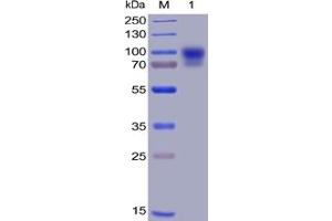 Human SIRPα, hFc-His Tag on SDS-PAGE under reducing condition. (SIRPA Protein (Fc-His Tag))