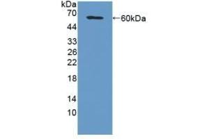 Detection of Recombinant MFAP2, Mouse using Polyclonal Antibody to Microfibrillar Associated Protein 2 (MFAP2) (MFAP2 抗体  (AA 32-178))
