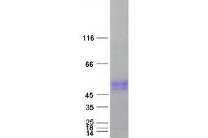 Western Blotting (WB) image for Solute Carrier Family 30, Member 10 (SLC30A10) protein (Myc-DYKDDDDK Tag) (ABIN2732349)