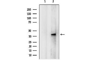 Western blot analysis of lysates from Mouse kidney, using GN Antibody.