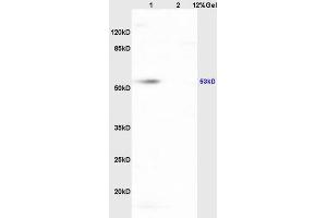 Lane 1: mouse heart lysates Lane 2: mouse brain lysates probed with Anti HCLS1/LckBP1 Polyclonal Antibody, Unconjugated (ABIN709811) at 1:200 in 4 °C. (HCLS1 抗体  (AA 161-260))