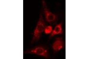 ABIN6275051 staining Hela cells by IF/ICC. (PLA2G4C 抗体  (Internal Region))