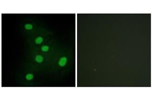 Immunofluorescence analysis of HepG2 cells, using NR2F6 antibody. (NR2F6 抗体  (N-Term))