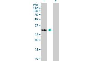 Western Blot analysis of ECHDC1 expression in transfected 293T cell line by ECHDC1 MaxPab polyclonal antibody. (ECHDC1 抗体  (AA 1-301))