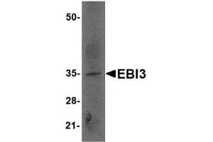 Image no. 2 for anti-Interleukin-27 subunit beta (IL-27b) (Internal Region) antibody (ABIN341721) (EBI3 抗体  (Internal Region))