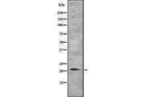 Western blot analysis of TGIF2LY using NIH-3T3 whole cell lysates (TGIF2LY 抗体)