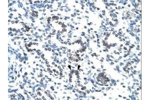 Image no. 1 for anti-EVX1 (EVX1) (AA 74-123) antibody (ABIN202451) (EVX1 抗体  (AA 74-123))
