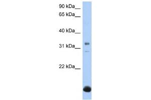Western Blotting (WB) image for anti-UDP-Gal:betaGal beta 1,3-Galactosyltransferase Polypeptide 6 (B3GALT6) antibody (ABIN2459385)