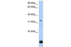 Western Blotting (WB) image for anti-UDP-Gal:betaGal beta 1,3-Galactosyltransferase Polypeptide 6 (B3GALT6) antibody (ABIN2459385) (B3GALT6 抗体)