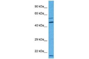 Host:  Rabbit  Target Name:  MBOAT1  Sample Tissue:  Human 786-0 Whole Cell  Antibody Dilution:  1ug/ml (MBOAT1 抗体  (N-Term))