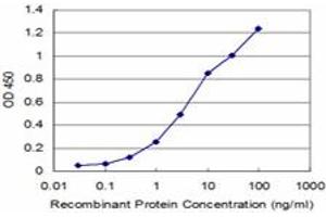 Detection limit for recombinant GST tagged NEK2 is approximately 0. (NEK2 抗体  (AA 331-445))