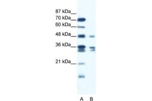 Western Blotting (WB) image for anti-Zinc Finger Protein 577 (ZNF577) antibody (ABIN2461281) (ZNF577 抗体)
