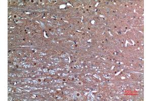 Immunohistochemistry (IHC) analysis of paraffin-embedded Rat Brain, antibody was diluted at 1:100. (Latexin 抗体  (Internal Region))