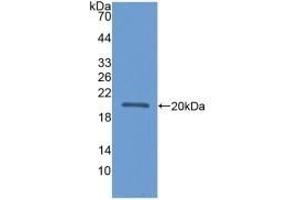 Detection of Recombinant APOL2, Human using Polyclonal Antibody to Apolipoprotein L2 (APOL2) (Apolipoprotein L 2 抗体  (AA 186-337))