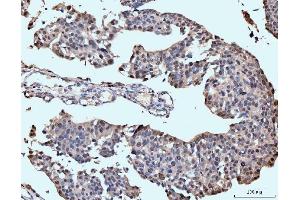 IHC analysis of Neurofibromin/NF1 using anti-Neurofibromin/NF1 antibody (ABIN7600196). (Neurofibromin 1 抗体  (AA 160-270))