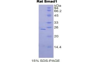 SDS-PAGE analysis of Rat Smad1 Protein. (SMAD1 蛋白)