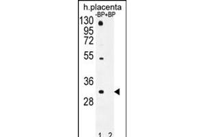 Western blot analysis of OR1D5 Antibody (C-term) Pab (ABIN655952 and ABIN2845338) pre-incubated without(lane 1) and with(lane 2) blocking peptide in human placenta tissue lysate. (OR1D5 抗体  (C-Term))