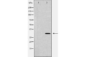 Western blot analysis of HEX293  lysate using CDCA8 antibody. (CDCA8 抗体)