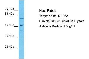 Host: Rabbit Target Name: NUP62 Sample Type: Jurkat Whole Cell lysates Antibody Dilution: 1. (NUP62 抗体  (Middle Region))