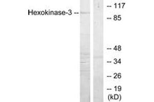 Western blot analysis of extracts from Jurkat cells, treated with insulin 0. (HK3 抗体  (AA 811-860))